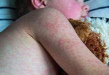 Advierten que quienes viajaron en colectivo por Entre Ríos están expuestos a una enfermedad contagiosa